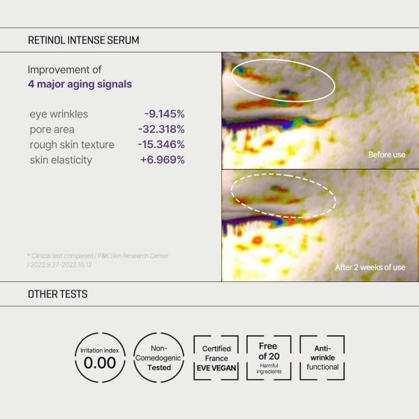 Some By Mi Retinol Intense Trial Kit (2components) 10 ml - Image 6
